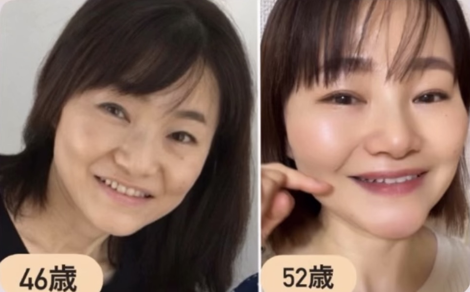 顔ヨガによるお顔の変化（46歳から52歳）